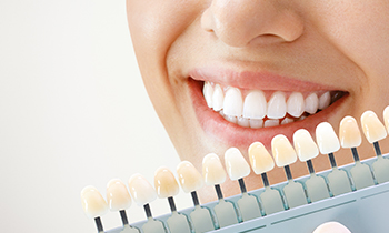 ホワイトニング